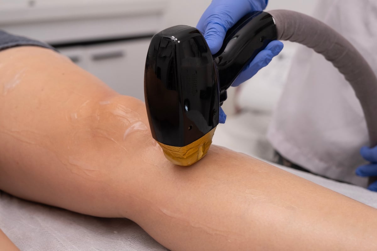 Laser epilation - hair removal procedure. Flash of diode laser hair removal